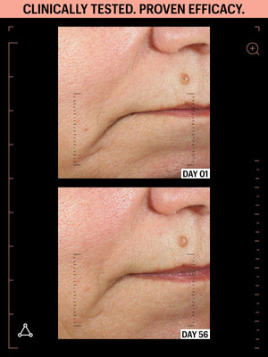 ULTIMATE LIFTING DUO