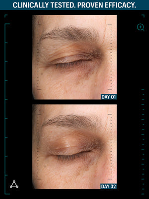 SMOOTH + FIRM EYES DUO