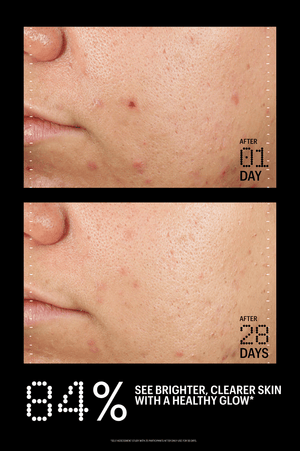 Azelaic & Kojic Advanced Clarifying Serum