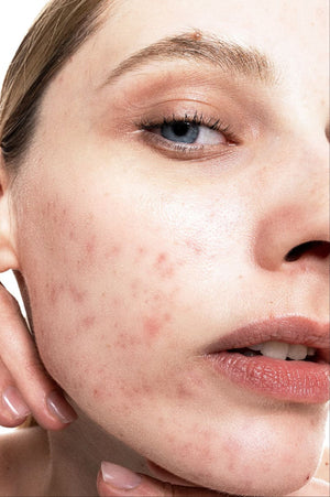 Clarify and Firm Routine