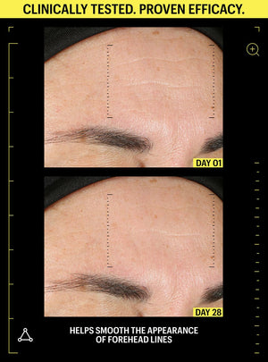 retinol anti wrinkle cream