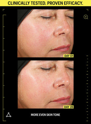 retinol before and after pores