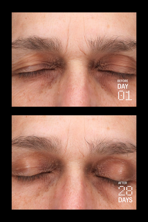 Multi Peptides & GF (Growth Factor) Advanced Lifting Serum