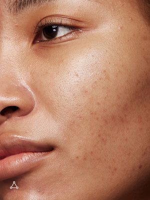 Deluxe Mandelic Pigmentation Corrector Night Serum