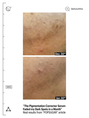 Deluxe Mandelic Pigmentation Corrector Night Serum