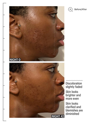 Deluxe Mandelic Pigmentation Corrector Night Serum